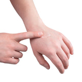 Hydrogel Burn Gel 3.5g Sachet 5pk